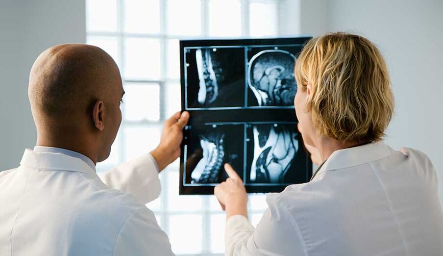 Diagnose der zervikalen Osteochondrose durch Bilder
