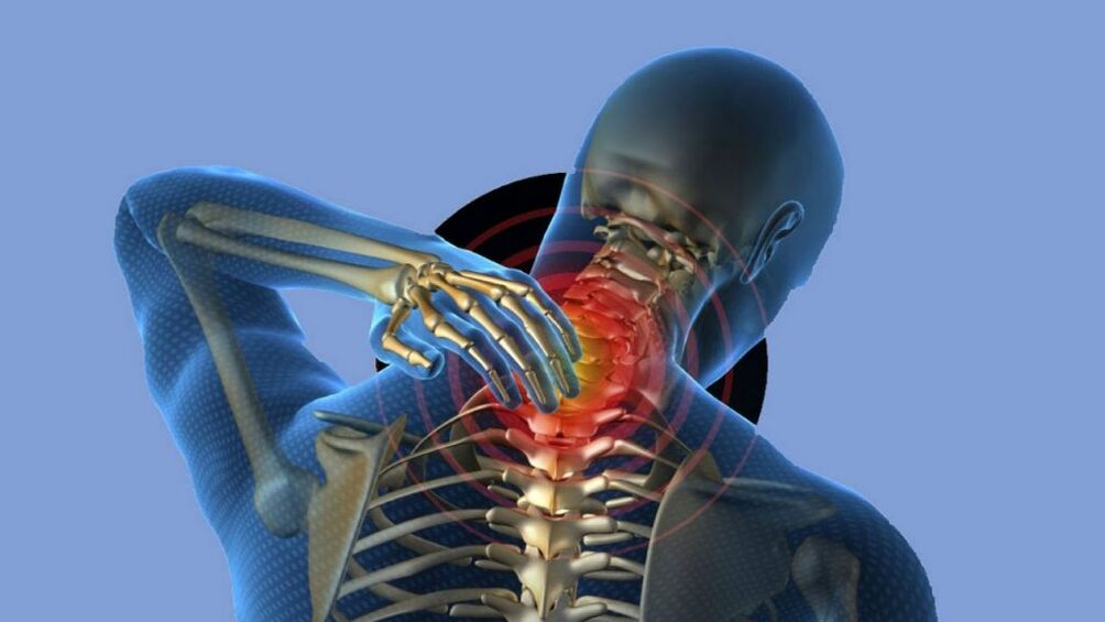 Osteochondrose der Gebärmutterhalsregion