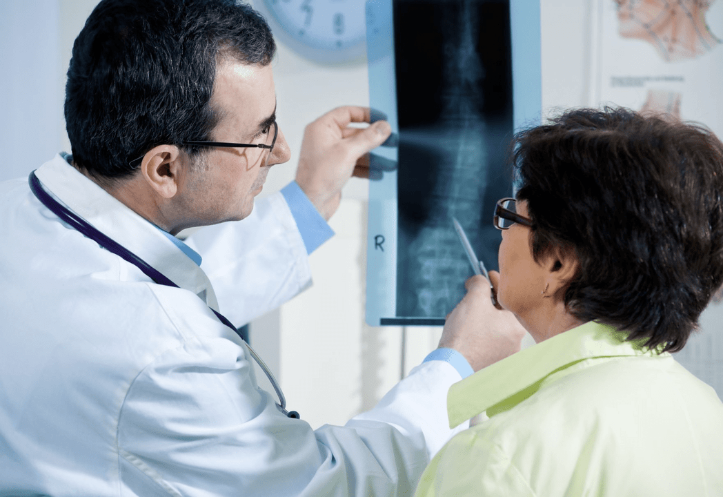 Ein Neurologe diagnostiziert Osteochondrose anhand einer Röntgenaufnahme der Wirbelsäule