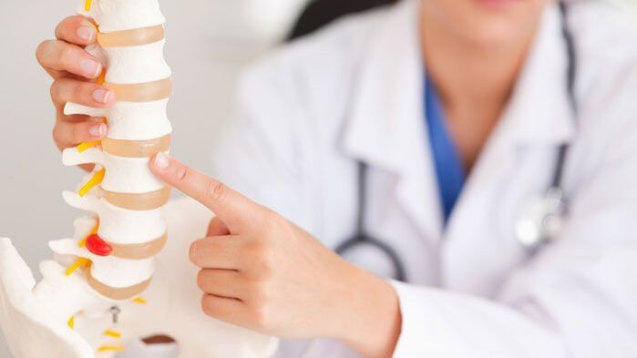 Erklärung der lumbalen Osteochondrose am Modell der Wirbelsäule